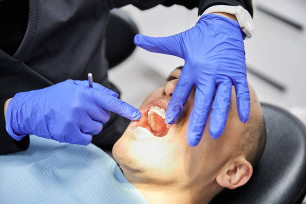Best Emergency Tooth Extraction in Bigfoot, TX